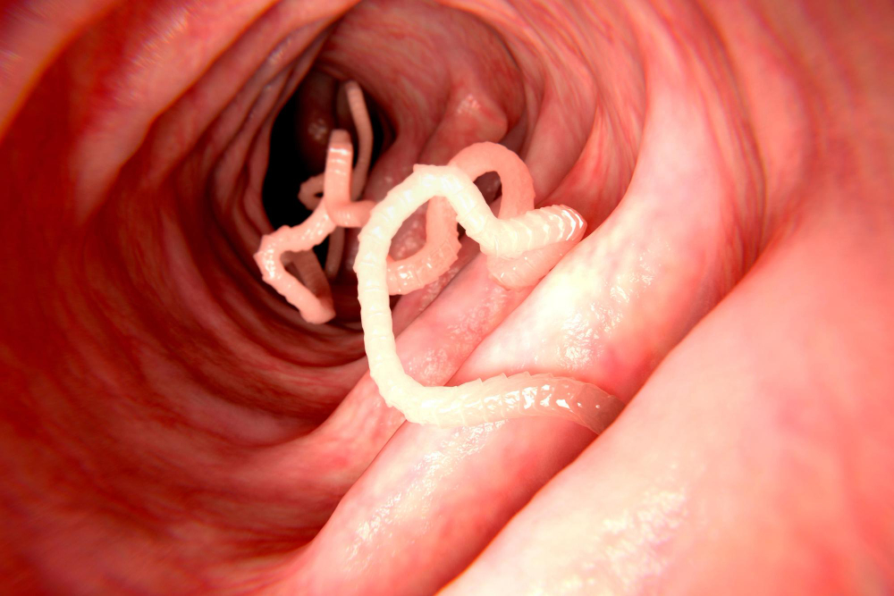 Tapeworm Human Intestine Illustration