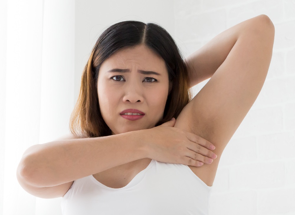 Problem Black Armpit Of Pregnant Women, Asian Model