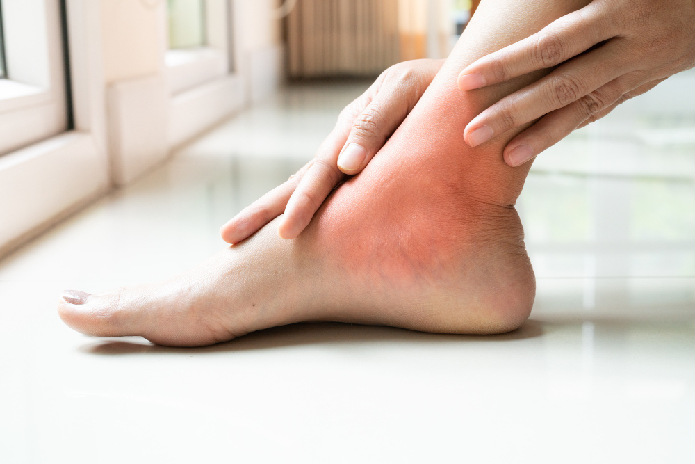 Women Leg Ankle Injury Painful Women Touch Pain Ankle Leg